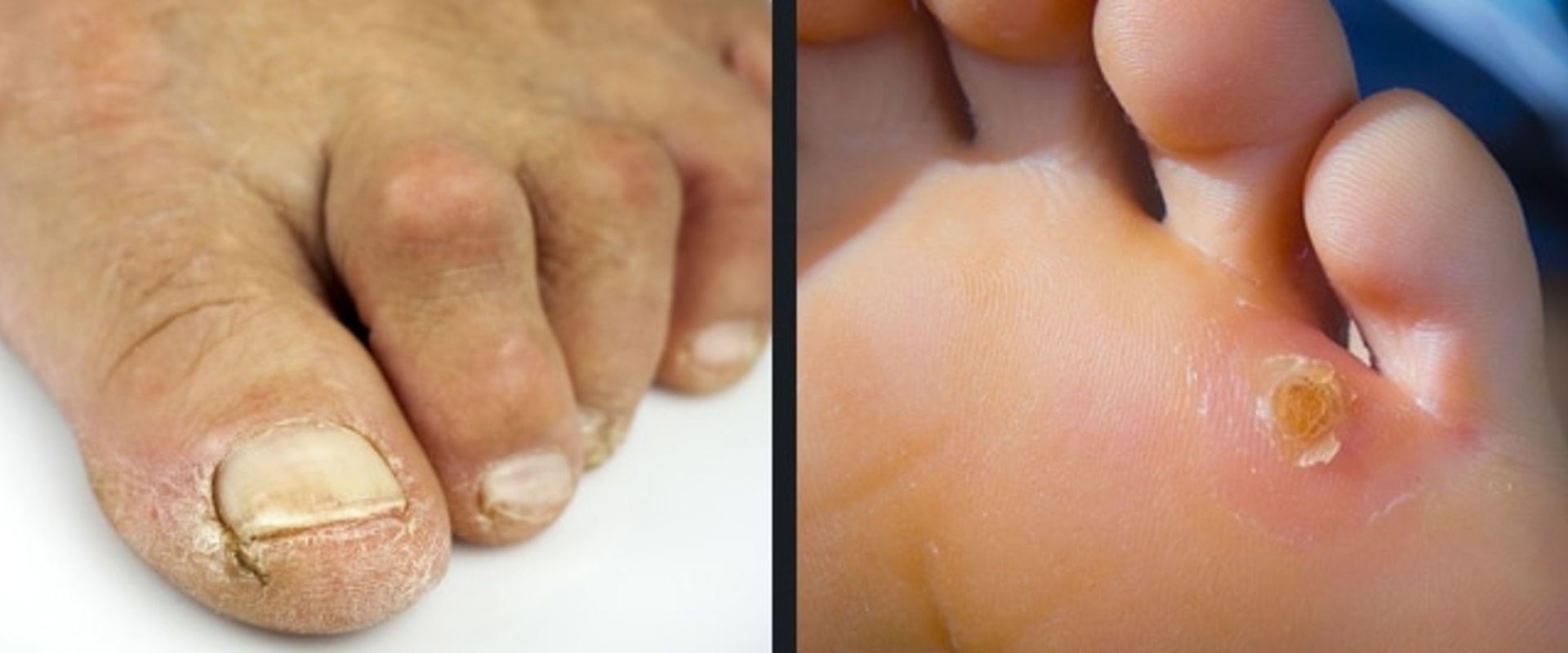 Expert's Guide to Common Foot Disorders