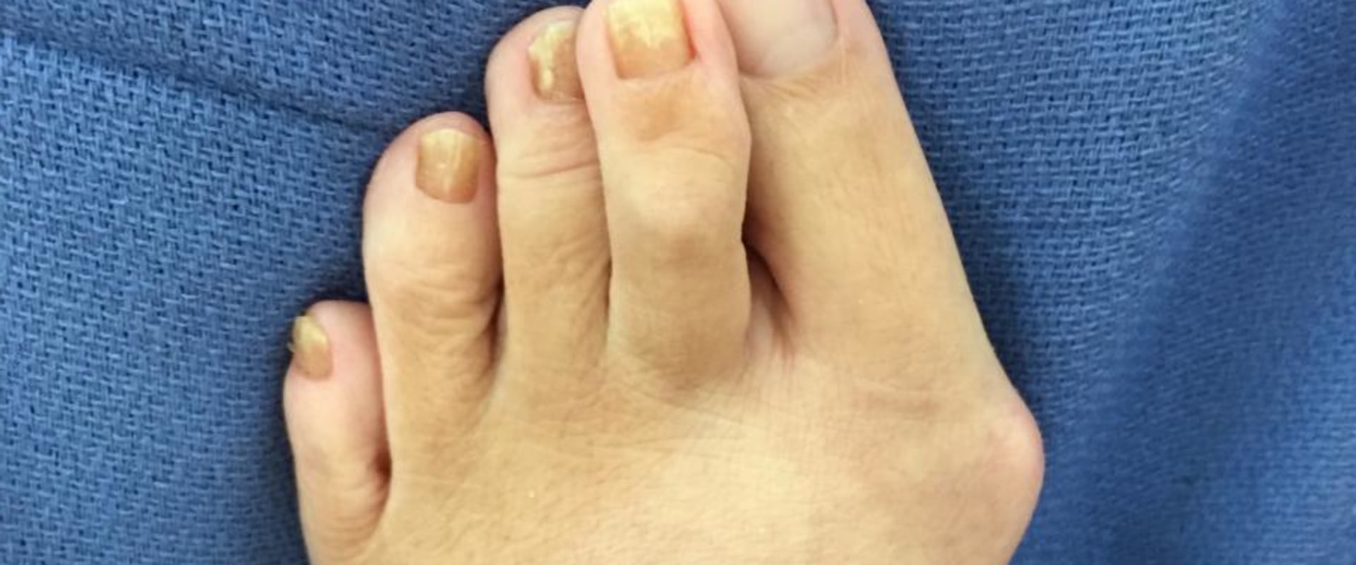 Expert Insights: Understanding and Treating Common Foot Problems