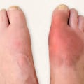 The Most Common and Painful Foot Conditions and How to Treat Them