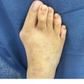 Expert Insights: Understanding and Treating Common Foot Problems