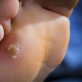 The Most Common Foot Problems and How to Treat Them