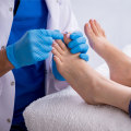 Chiropodist Vs Podiatrist: Who's the Better Foot Specialist For Your Foot Health?