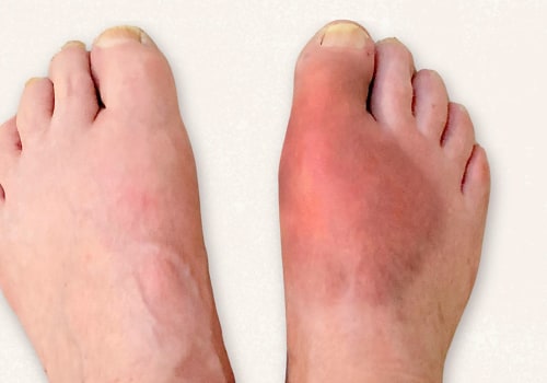 The Most Common and Painful Foot Conditions and How to Treat Them