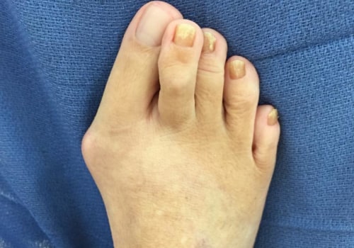 Expert Insights: Understanding and Treating Common Foot Problems