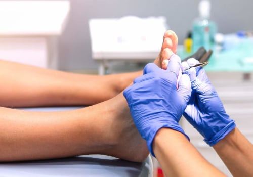 Expert Insights: Common Conditions Treated by Podiatrists