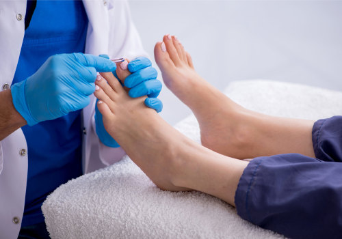 Chiropodist Vs Podiatrist: Who's the Better Foot Specialist For Your Foot Health?