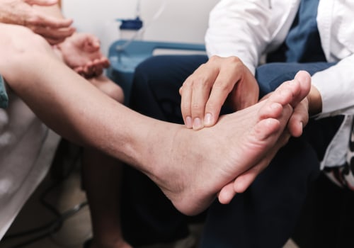 Choosing the Right Doctor for Foot Surgery